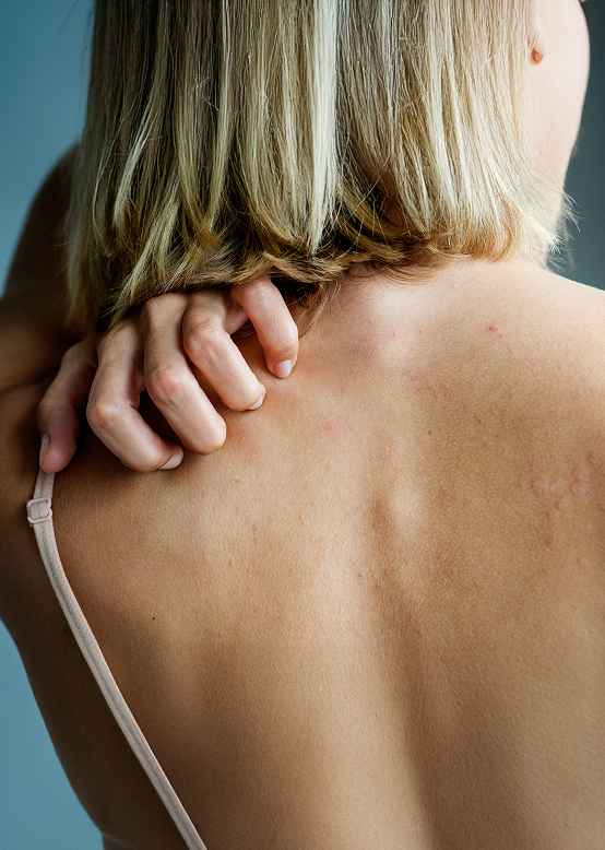 Dermascore – substances irritantes